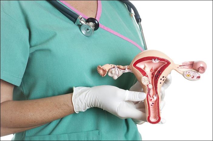 Cắt bỏ tử cung có thể tăng nguy cơ bị đột quỵ.