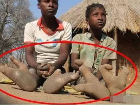 Bộ tộc 'đà điểu' gốc Phi chỉ có 2 ngón chân, các chuyên gia đã đến để tiết lộ sự thật