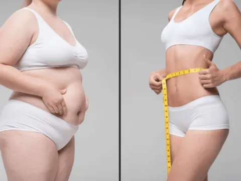 Sự thật gây sốc: Mỡ thừa khi giảm cân thoát ra ngoài chủ yếu bằng hơi thở